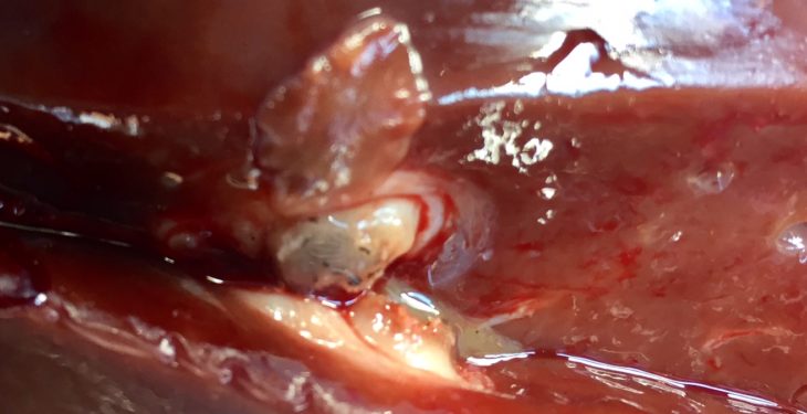 Revealed Which county has the worst liver fluke record